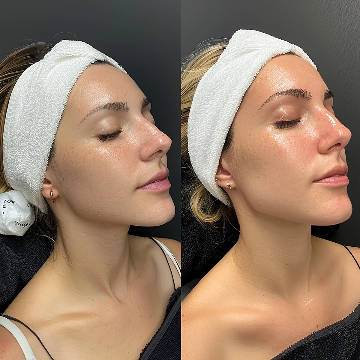 woman with white headband her head 1