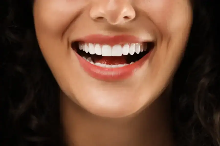 All On X 30 Full Mouth Implants