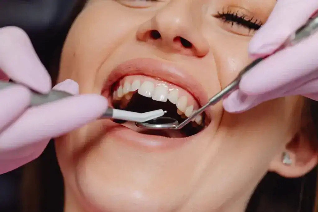 All On X 28 Signs You May Need Full Mouth Implants
