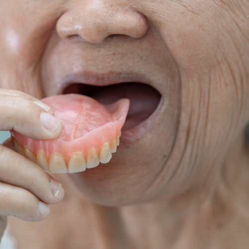 Dentures