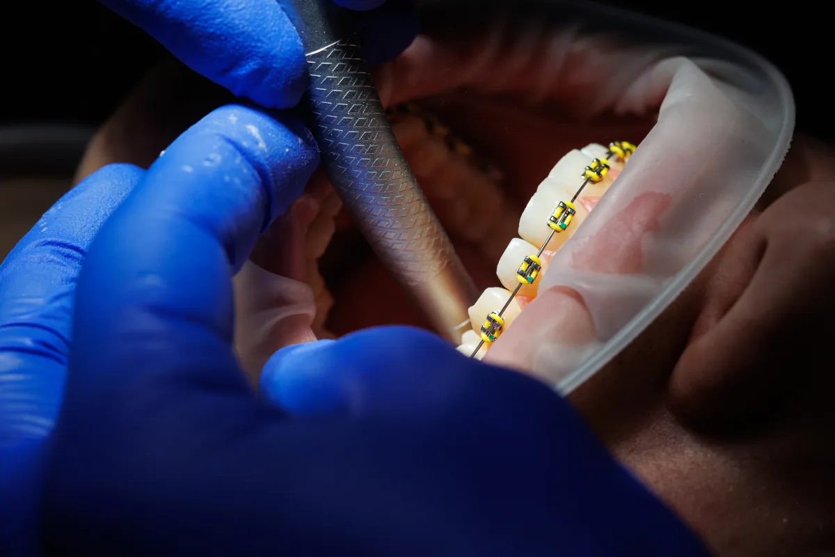 Orthodontics