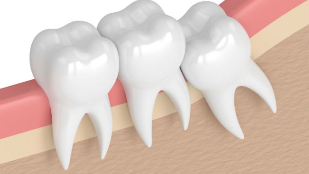 How Do Dentists Manage Pain During Teeth Extraction? 1 Teeth Extraction
