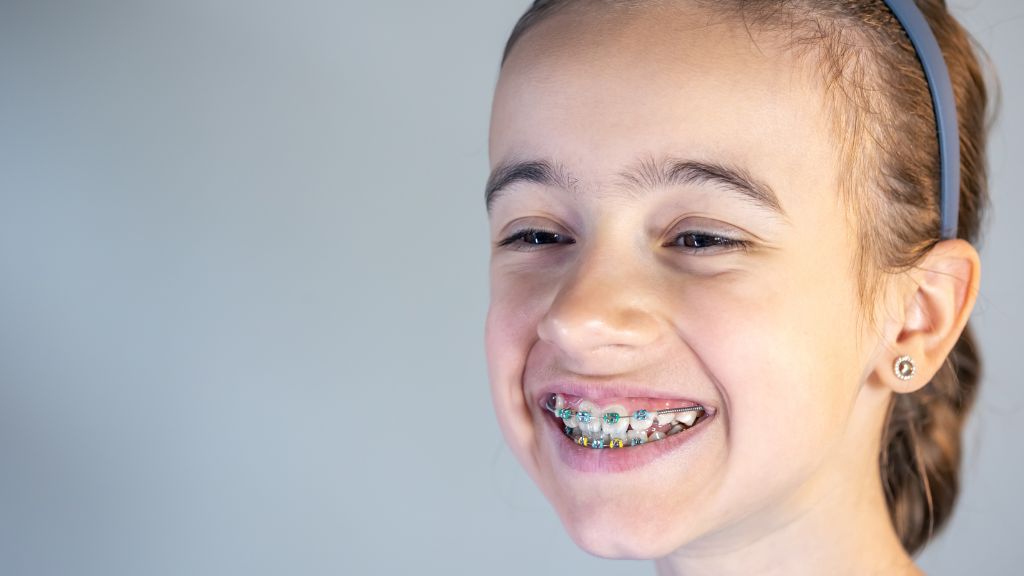 Braces for Kids