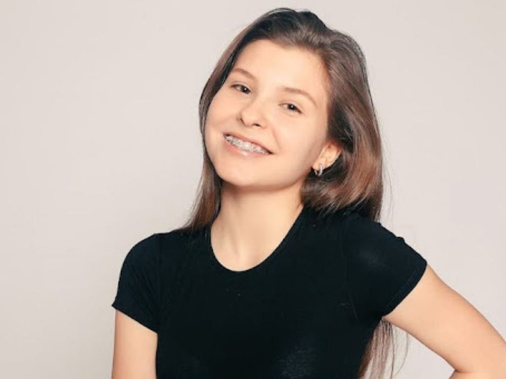Ceramic Braces