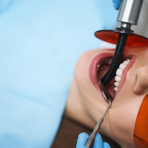 woman is getting root canal stock photo r8e7msilz3nrleq6ap20vvks3b97ehy9bsx142prbc
